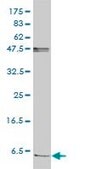 Monoclonal Anti-FXYD2 antibody produced in mouse clone 1C3-B3, purified immunoglobulin, buffered aqueous solution