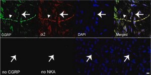 Anti-Na+K+ ATPase &#945;-2 Antibody serum, Upstate&#174;