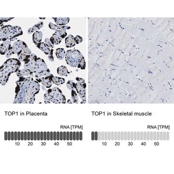 Anti-TOP1 antibody produced in rabbit Prestige Antibodies&#174; Powered by Atlas Antibodies, affinity isolated antibody, buffered aqueous glycerol solution