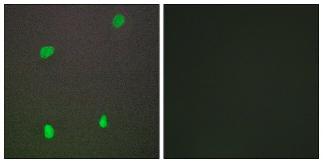 Anti-XRCC3 antibody produced in rabbit affinity isolated antibody