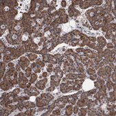 Anti-MAN2A1 antibody produced in rabbit Prestige Antibodies&#174; Powered by Atlas Antibodies, affinity isolated antibody, buffered aqueous glycerol solution