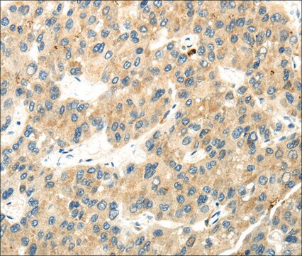 Anti-WDR36 affinity isolated antibody