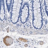 Anti-APOL1 antibody produced in rabbit Prestige Antibodies&#174; Powered by Atlas Antibodies, affinity isolated antibody, buffered aqueous glycerol solution