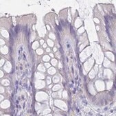 Anti-CYP51A1 antibody produced in rabbit Prestige Antibodies&#174; Powered by Atlas Antibodies, affinity isolated antibody, buffered aqueous glycerol solution