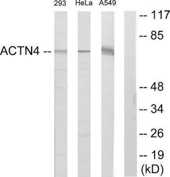Anti-ACTN1 antibody produced in rabbit affinity isolated antibody