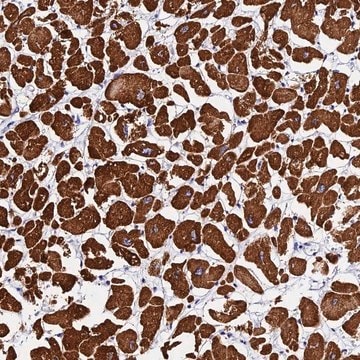 Anti-FBXW9 antibody produced in rabbit Prestige Antibodies&#174; Powered by Atlas Antibodies, affinity isolated antibody, buffered aqueous glycerol solution