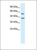 Anti-HTR3B antibody produced in rabbit affinity isolated antibody