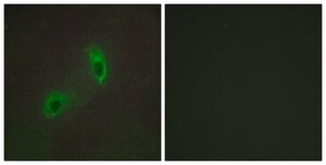 Anti-HGS antibody produced in rabbit affinity isolated antibody