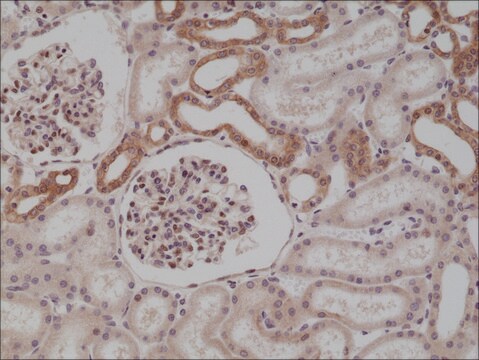 Anti-MYD88 antibody, Rabbit Monoclonal recombinant, expressed in HEK 293 cells, clone RM306, purified immunoglobulin