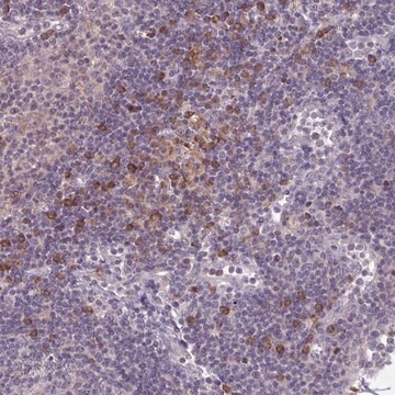 Anti-CD1E antibody produced in rabbit Prestige Antibodies&#174; Powered by Atlas Antibodies, affinity isolated antibody, buffered aqueous glycerol solution