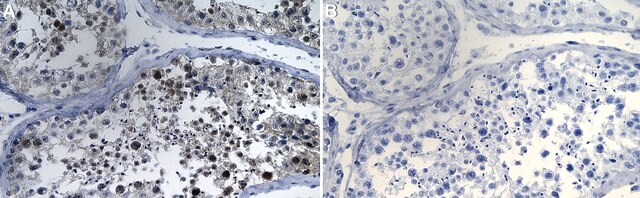 Anti-KANSL2 Antibody, clone 3L12 ZooMAb&#174; Rabbit Monoclonal recombinant, expressed in HEK 293 cells