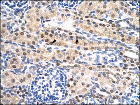 Anti-SULF2 IgG fraction of antiserum