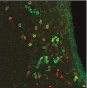 Anti-ARP2 antibody, Mouse monoclonal clone FMS96, purified from hybridoma cell culture