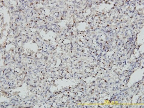 Monoclonal Anti-MEIS2 antibody produced in mouse clone 1H4, purified immunoglobulin, buffered aqueous solution