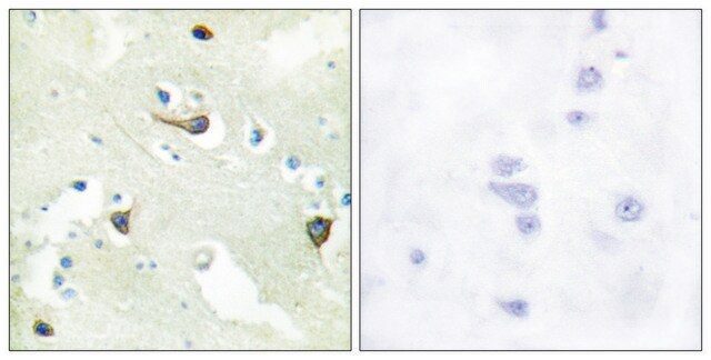 Anti-EPHB1 antibody produced in rabbit affinity isolated antibody