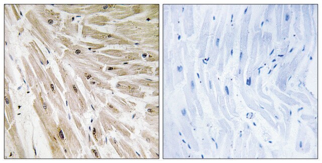 Anti-RPL22 antibody produced in rabbit affinity isolated antibody