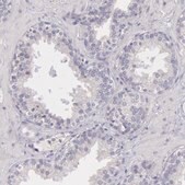 Anti-MYH6 antibody produced in rabbit Prestige Antibodies&#174; Powered by Atlas Antibodies, affinity isolated antibody, buffered aqueous glycerol solution