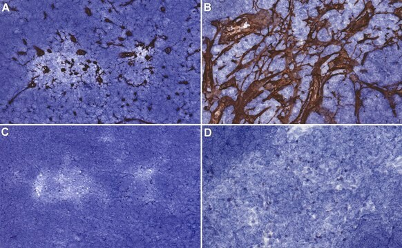 Anti-Reticular fibroblasts Antibody, clone ER-TR7