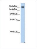 Anti-SCN5A antibody produced in rabbit affinity isolated antibody