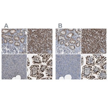 Anti-ACBD5 antibody produced in rabbit Prestige Antibodies&#174; Powered by Atlas Antibodies, affinity isolated antibody, buffered aqueous glycerol solution