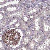 Monoclonal Anti-LAMB2 antibody produced in mouse Prestige Antibodies&#174; Powered by Atlas Antibodies, clone CL2979, purified immunoglobulin, buffered aqueous glycerol solution