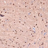 Anti-Carbonic Anhydrase 1 (CA2) antibody produced in rabbit