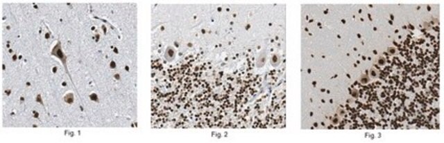 Anti-Tdp43 Antibody, clone 3H8 clone 3H8, from mouse