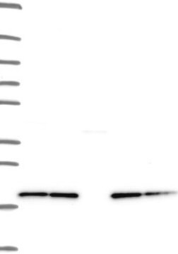 Anti-NDUFB8 antibody produced in rabbit Prestige Antibodies&#174; Powered by Atlas Antibodies, affinity isolated antibody, buffered aqueous glycerol solution