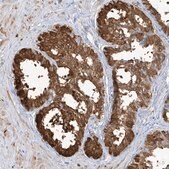 Anti-TGM4 antibody produced in rabbit Prestige Antibodies&#174; Powered by Atlas Antibodies, affinity isolated antibody, buffered aqueous glycerol solution