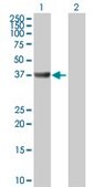 Anti-ADA antibody produced in rabbit purified immunoglobulin, buffered aqueous solution
