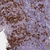 Anti-SLAMF7 antibody produced in rabbit Prestige Antibodies&#174; Powered by Atlas Antibodies, affinity isolated antibody, buffered aqueous glycerol solution