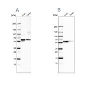 Anti-SERPINA1 antibody produced in rabbit Prestige Antibodies&#174; Powered by Atlas Antibodies, affinity isolated antibody, buffered aqueous glycerol solution