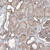 Anti-DST antibody produced in rabbit Prestige Antibodies&#174; Powered by Atlas Antibodies, affinity isolated antibody, buffered aqueous glycerol solution