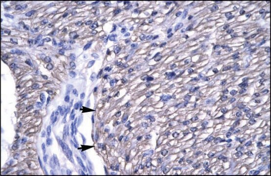 Anti-OTX2 antibody produced in rabbit affinity isolated antibody