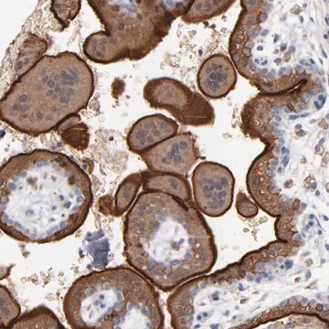 Anti-PDLIM2 antibody produced in rabbit Prestige Antibodies&#174; Powered by Atlas Antibodies, affinity isolated antibody, buffered aqueous glycerol solution