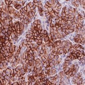 Monoclonal Anti-CA12 antibody produced in mouse Prestige Antibodies&#174; Powered by Atlas Antibodies, clone CL0280, purified immunoglobulin, buffered aqueous glycerol solution