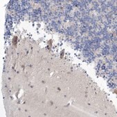 Anti-GABRG1 antibody produced in rabbit Prestige Antibodies&#174; Powered by Atlas Antibodies, affinity isolated antibody, buffered aqueous glycerol solution