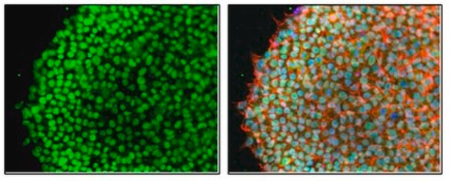 Anti-SnoN Antibody from rabbit, purified by affinity chromatography