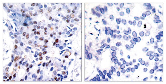 Anti-JUN (Ab-91) antibody produced in rabbit affinity isolated antibody