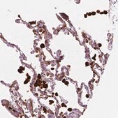Anti-CES1 antibody produced in rabbit Prestige Antibodies&#174; Powered by Atlas Antibodies, affinity isolated antibody, buffered aqueous glycerol solution