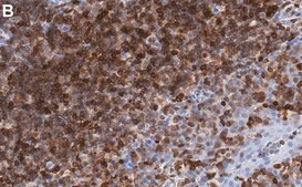 Anti-NFAT1 Antibody, clone 1D19 ZooMAb&#174; Rabbit Monoclonal recombinant, expressed in HEK 293 cells