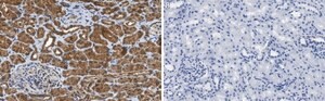 Anti-VEGF Receptor-3 Antibody, clone 9D9F9