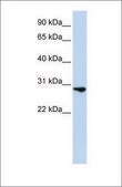 Anti-FGF2 antibody produced in rabbit affinity isolated antibody