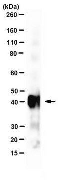 Anti-Chlamydial MOMP Antibody, clone L21-10 clone L21-10, from mouse