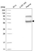 Anti-SERPINC1 antibody produced in rabbit Prestige Antibodies&#174; Powered by Atlas Antibodies, affinity isolated antibody, buffered aqueous glycerol solution