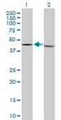 Anti-ESRRA antibody produced in rabbit purified immunoglobulin, buffered aqueous solution