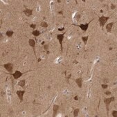Anti-PRKAR1B antibody produced in rabbit Prestige Antibodies&#174; Powered by Atlas Antibodies, affinity isolated antibody, buffered aqueous glycerol solution