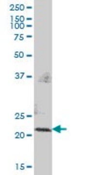 Anti-PMVK antibody produced in mouse purified immunoglobulin, buffered aqueous solution