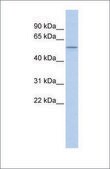 Anti-PPARD antibody produced in rabbit affinity isolated antibody