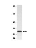 Anti-Bcl2 Antibody, clone 100 clone 100, Upstate&#174;, from mouse